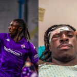 Moise Kean Cleared to Resume Competitive Play After Head Injury